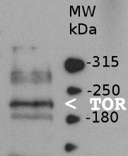 TOR | Target of rapamycin in the group Antibodies for Plant/Algal / Developmental Biology / Signal transduction at Agrisera AB (Antibodies for research) (AS12 2608)